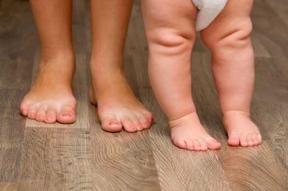 Deformacja Valgus u dzieci