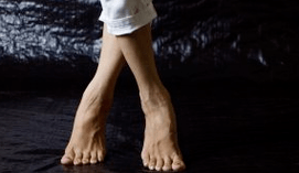 Deformacja Valgus