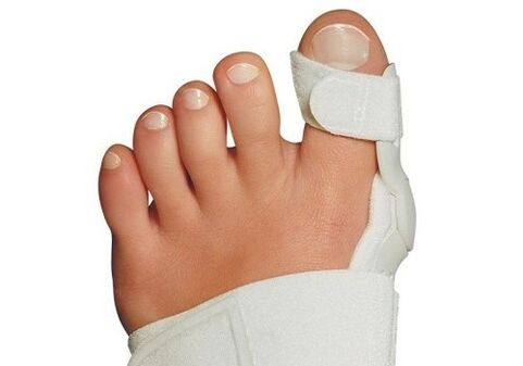 Deformacja Valgus